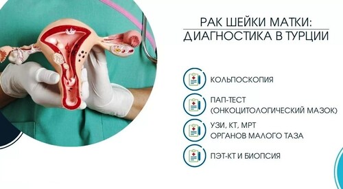 Клиники Турции – идеальный вариант лечения рака матки